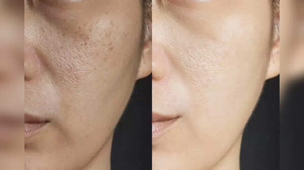 ​The master antioxidant your skin and body love